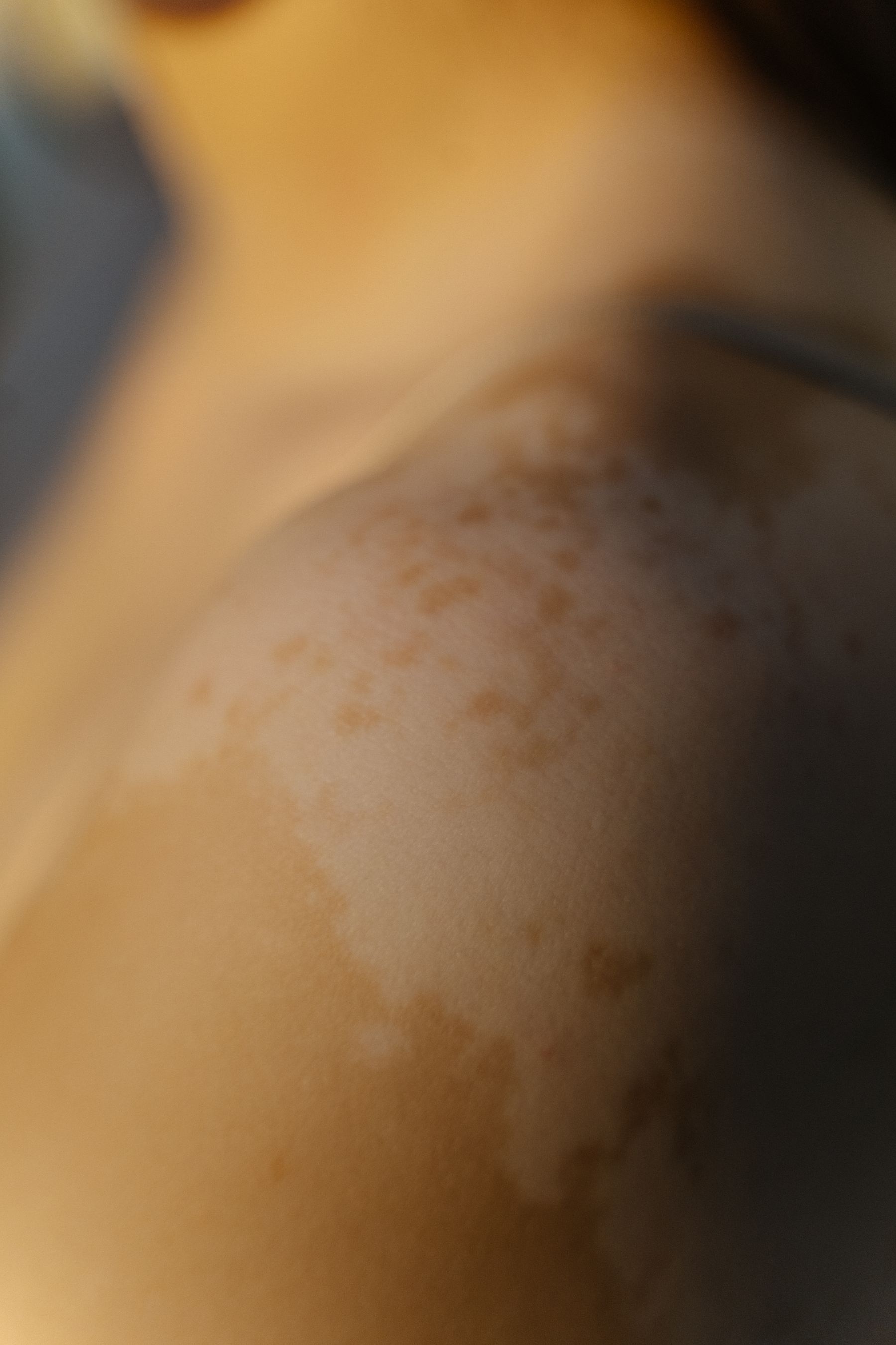 Close view of natural variation in skin tone